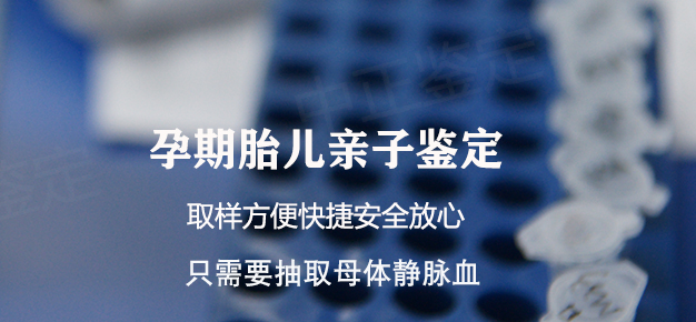 凉山怀孕了怎么做DNA鉴定,凉山孕期亲子鉴定具体的流程 凉山怀孕了怎么做DNA鉴定,凉山孕期亲子鉴定具体的流程